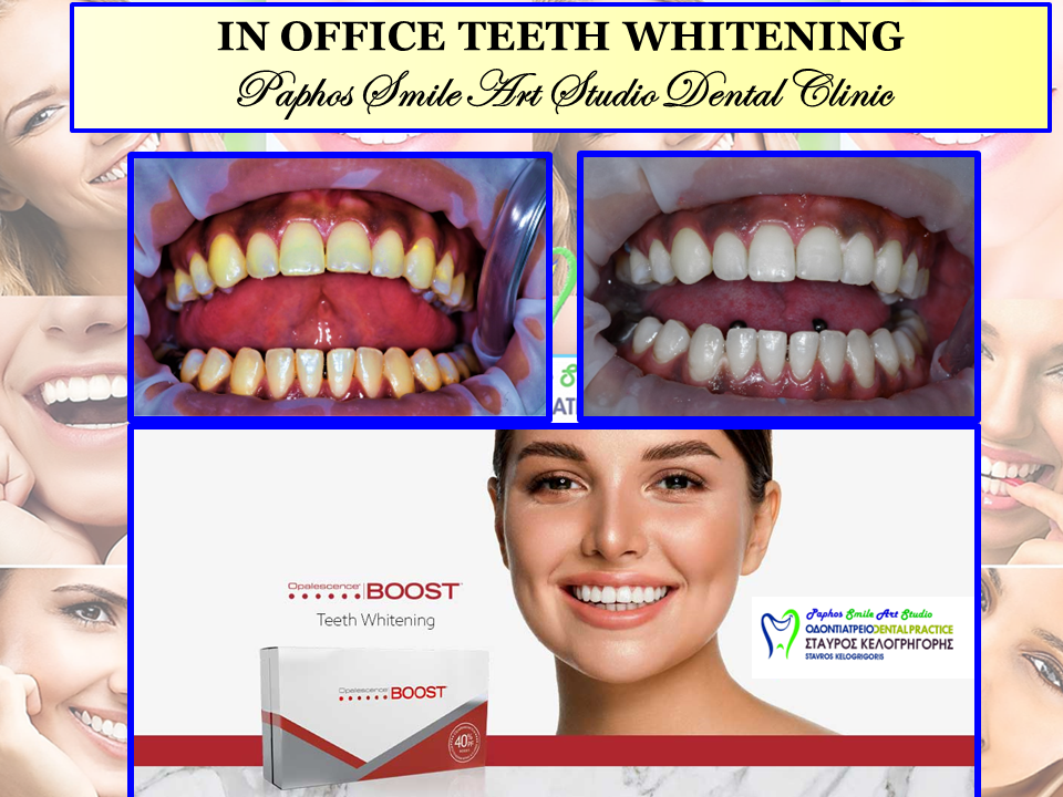 Dr Stavros Kelogrigoris Paphos Dental Clinic